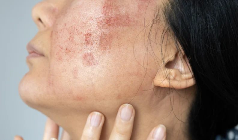 Diagnosis and Treatment of Skin Conditions
